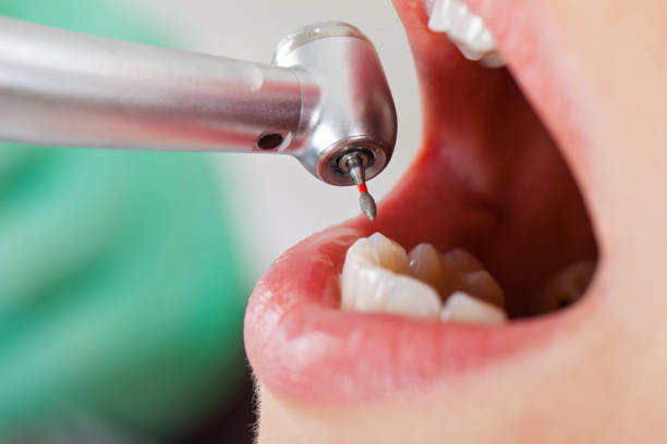 Best Emergency Tooth Extraction in Allendale, NJ